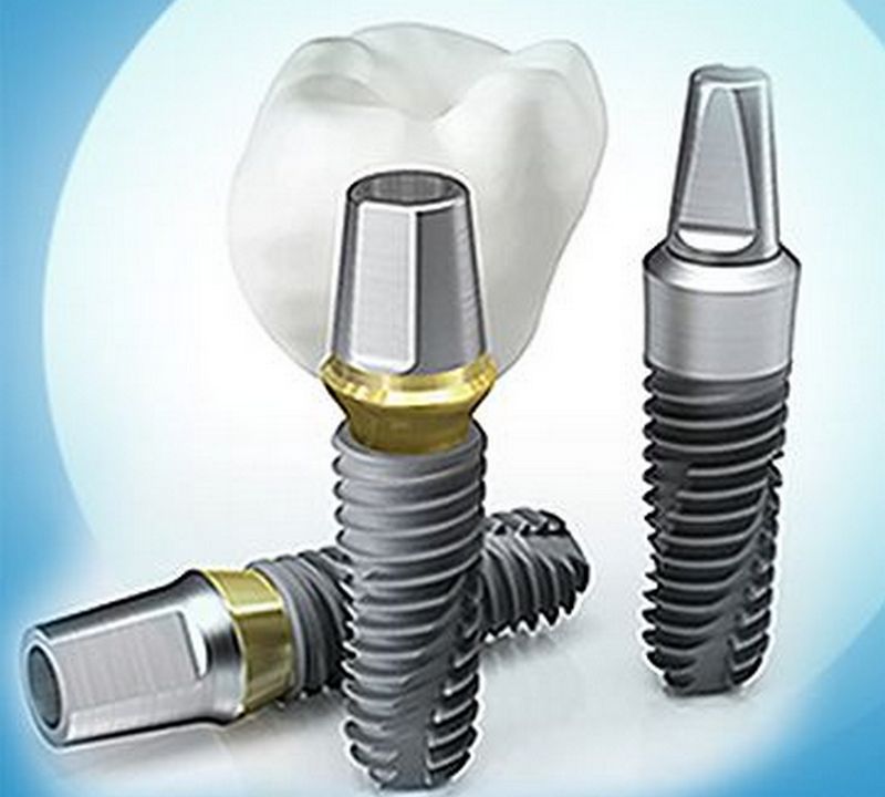 Зубной имплант спб. Имплант Osstem Южная Корея. Системы имплантатов в стоматологии. SGS импланты.